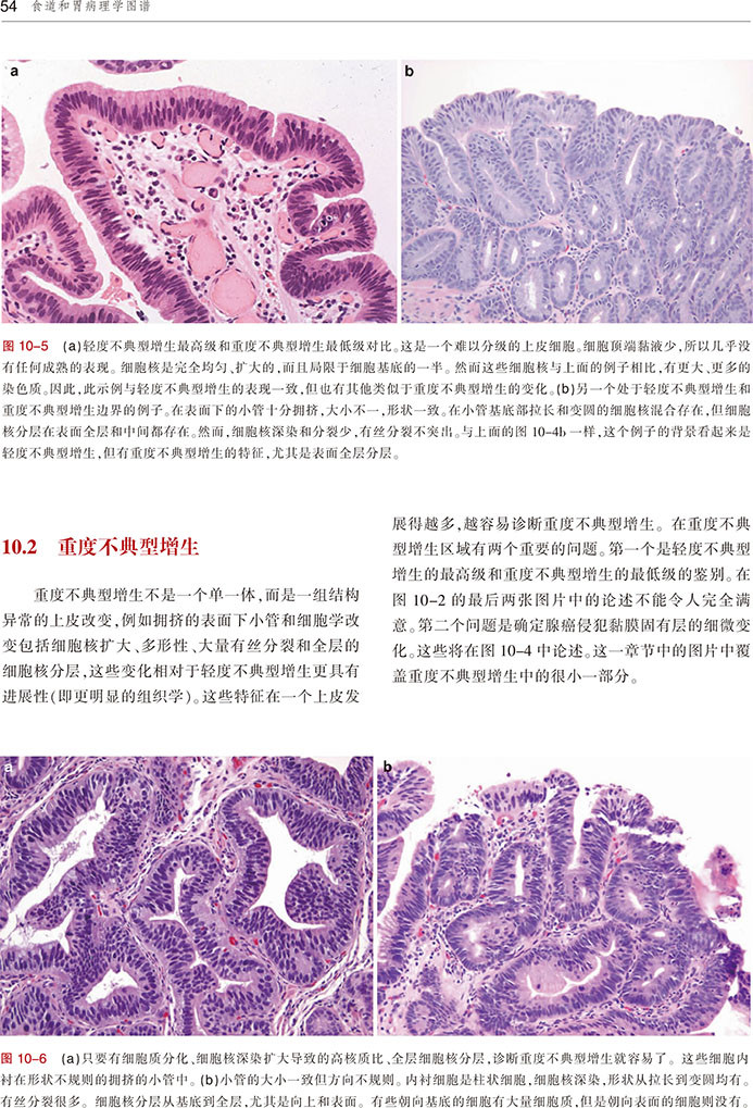 食道和胃病理学图谱