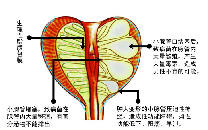 前列腺