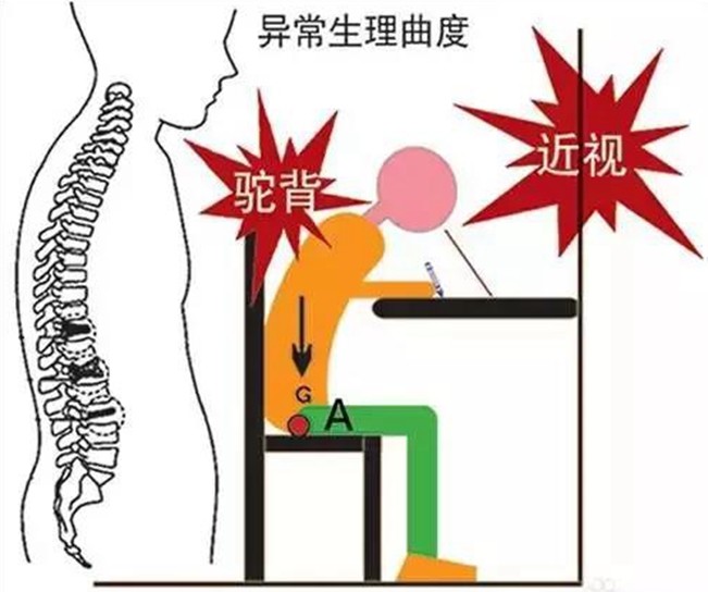 【襄阳青少年体态矫正】如何通过体态训练改善坏姿势呢!