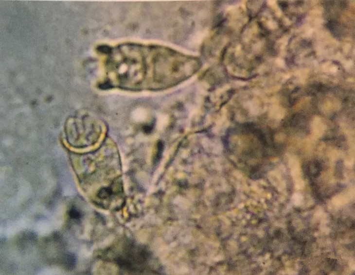 小瓜虫 d.杯体虫