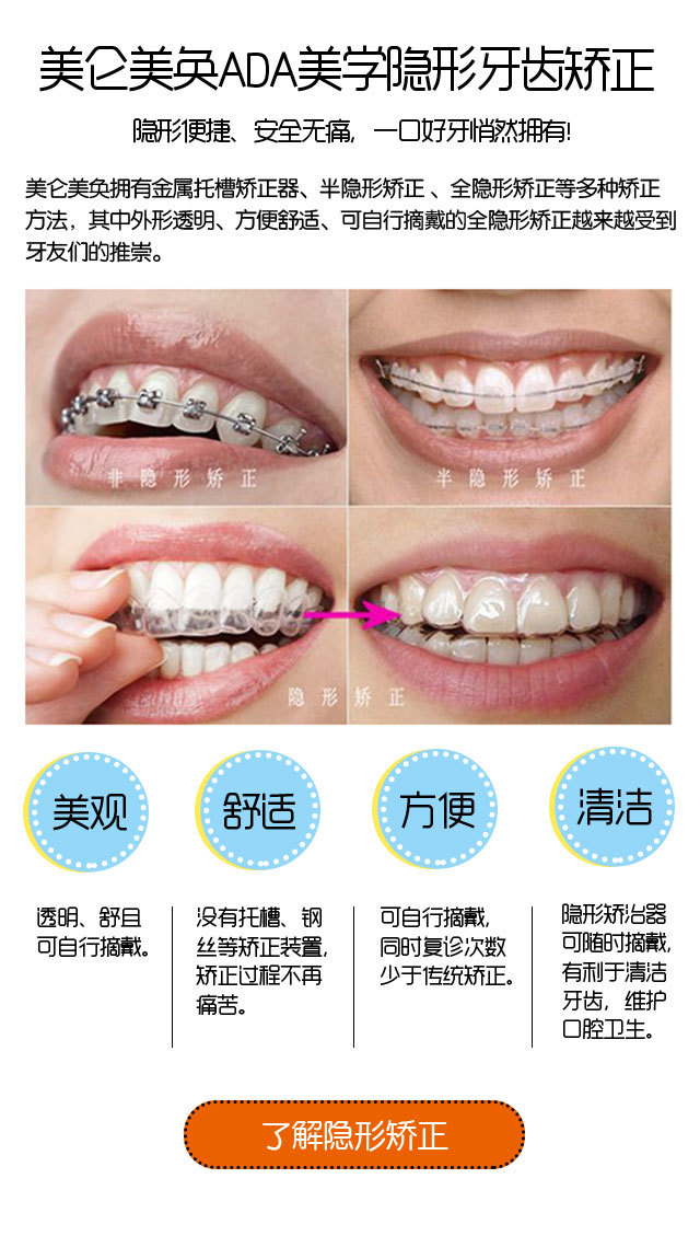 【全隐形矫正】艾诺克全隐形矫正 拒绝钢牙透明牙套无