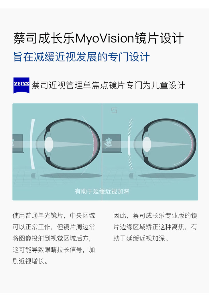 蔡司成长乐160167非球面铂金膜专业版儿童近视控制型眼镜片1片