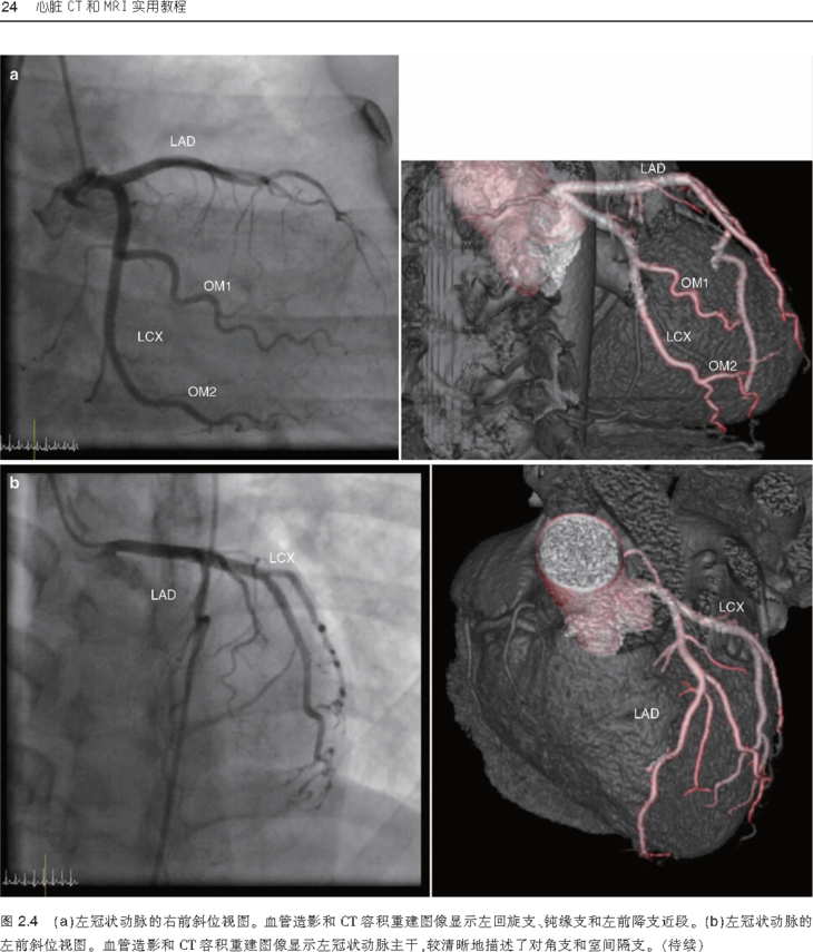 心脏ct和mri实用教程