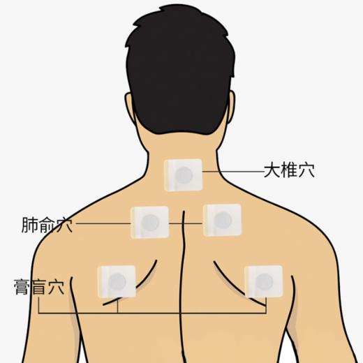买二送一南京同仁堂三伏贴艾灸贴穴位灸三湘四水艾叶贴穴位发热热敷贴