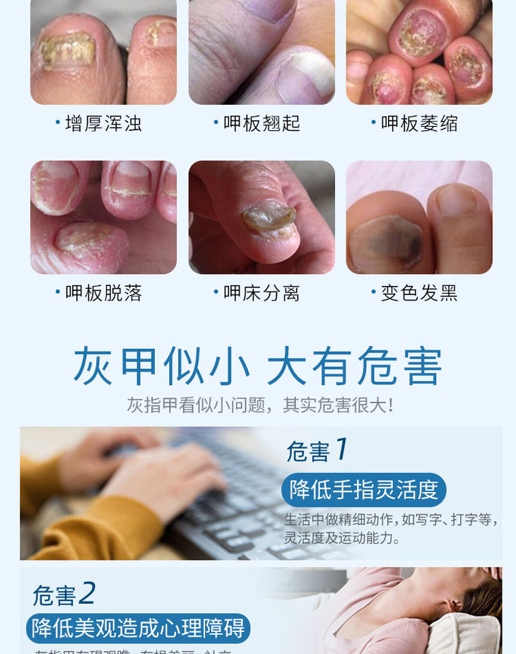 【拍一发一,拍二发四】灰指甲克星,植物草本精华,深层