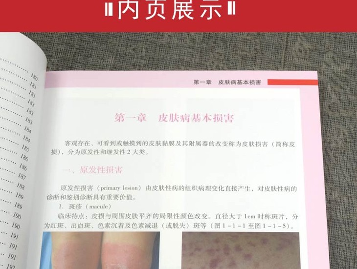 临床常见皮肤病彩色图谱