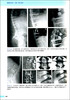 (AOSPINE)微创脊柱外科——技术、循证与争论 周悦主译 商品缩略图2