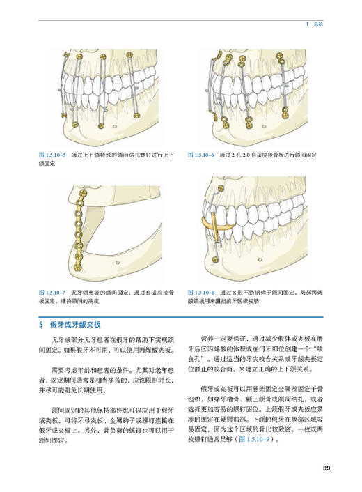 （AOCMF）颅颌面骨内固定原则—创伤与正颌外科 商品图3