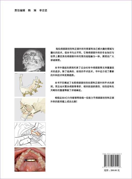（AOCMF）颅颌面骨内固定原则—创伤与正颌外科 商品图2