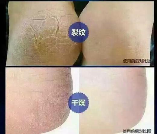 [现货]脚膜修复脚部肌肤粗糙 送爸妈一个关怀 78元包邮 商品图2