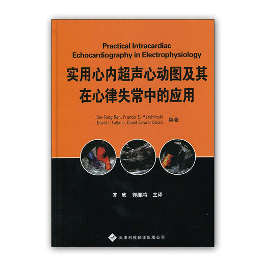 本书详细介绍了心内超声心动图在射频治疗心律失常的应用,包括心内