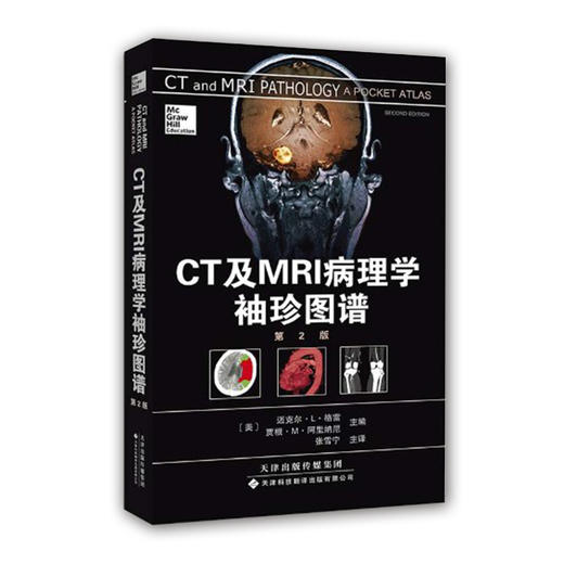 CT及MRI病理学袖珍图谱 第2版 商品图0