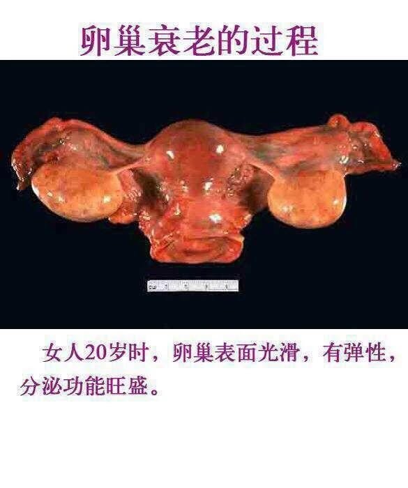 三八妇乐妇洁凝胶