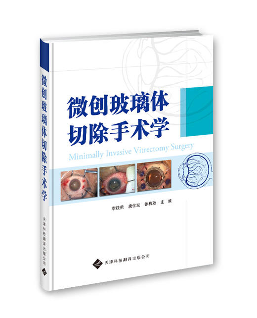 微创玻璃体切除手术学  商品图0