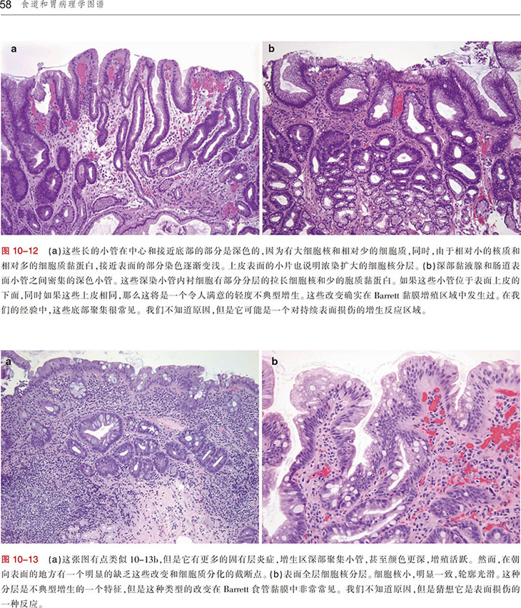 食道和胃病理學圖譜