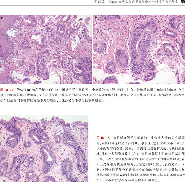 食道和胃病理學圖譜