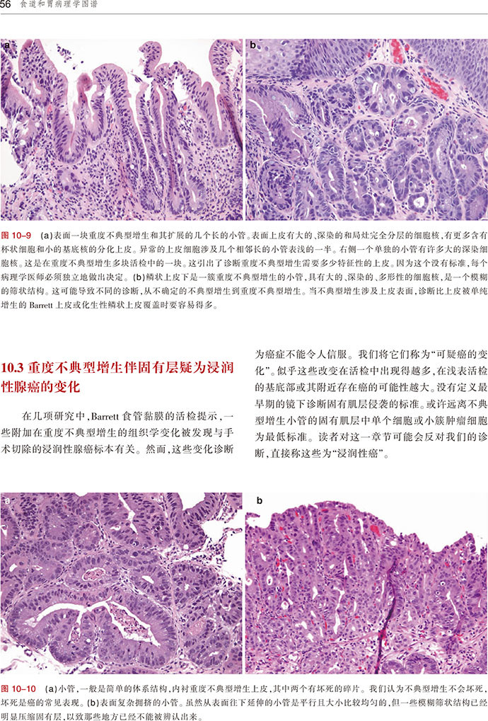 食道和胃病理学图谱