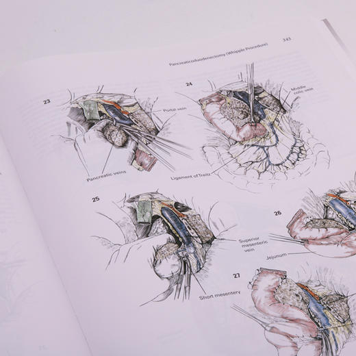 【正版包邮】Zollinger外科手术图谱（第10版）（英文版） Zollinger’s Atlas of Surgical Operations 商品图5