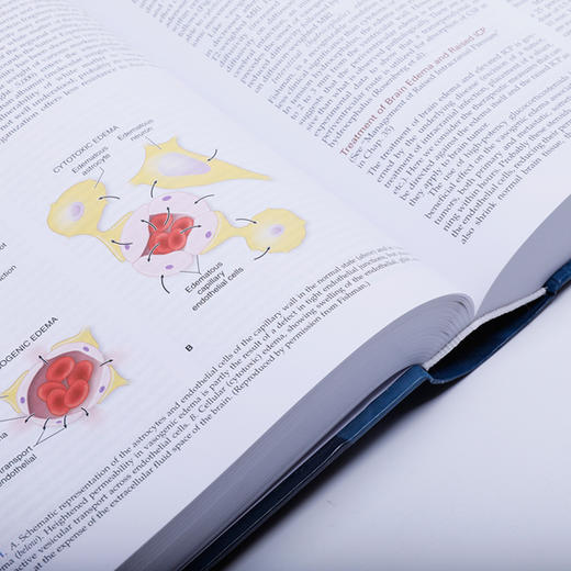 【正版包邮】Adams-Victor神经病学（第10版）（英文版）Adams and Victor’s Principle of Neurology 商品图3