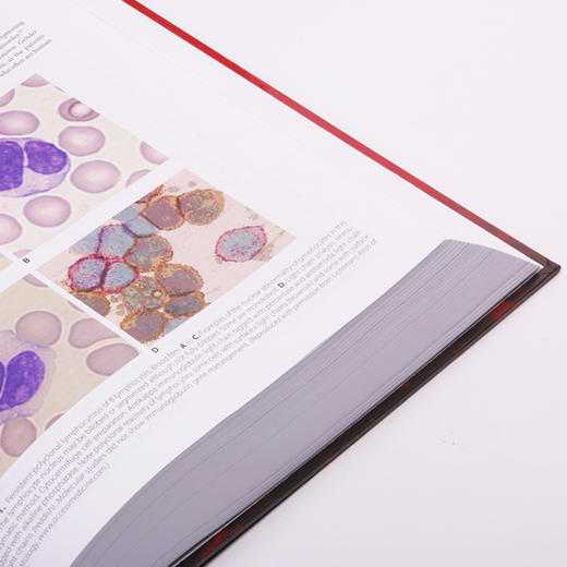 【正版包邮】Williams血液学（第9版）(英文版） Williams Hematology, 9th Edition 商品图5