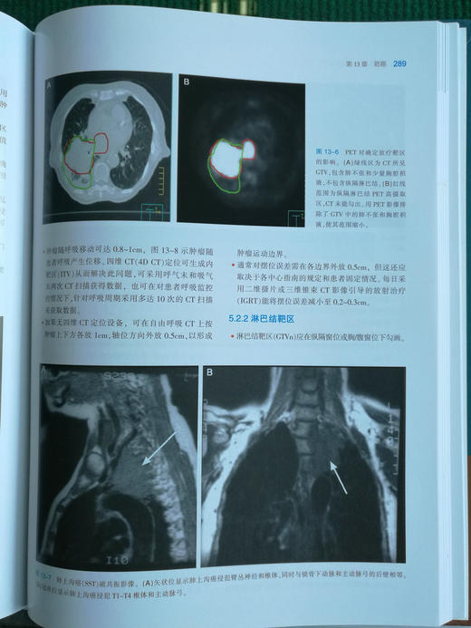 实用肿瘤调强放射治疗 商品图11