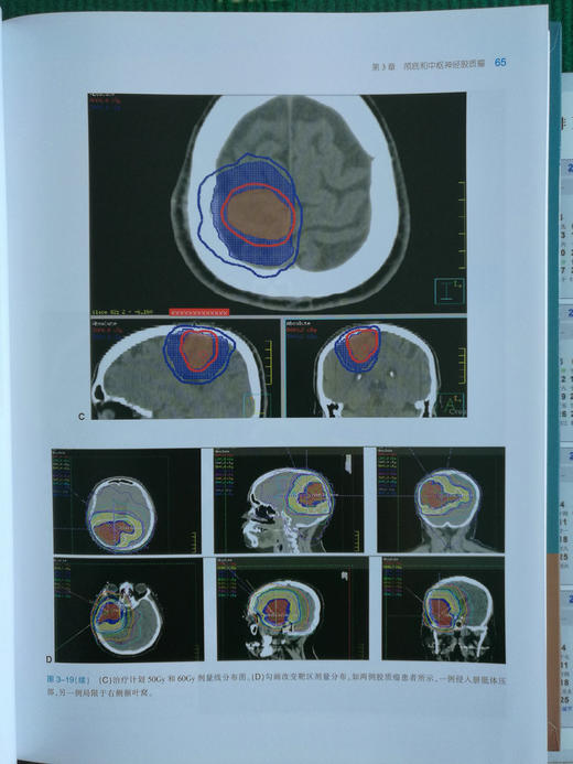 实用肿瘤调强放射治疗 商品图6