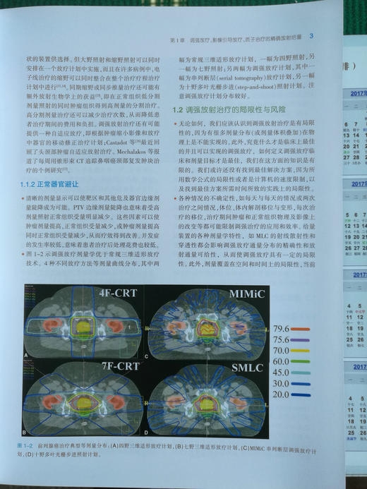 实用肿瘤调强放射治疗 商品图5