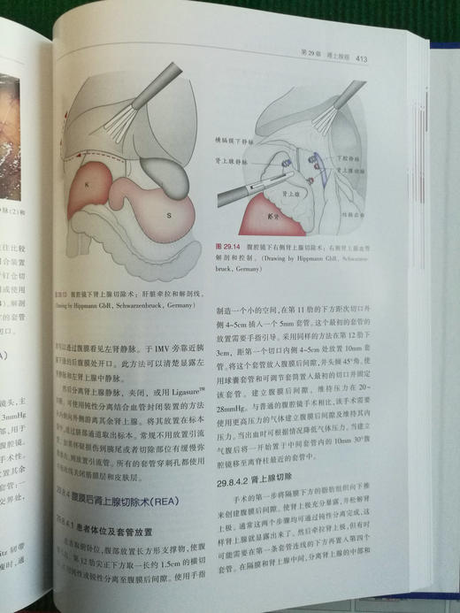 微创肿瘤外科学——肿瘤外科治疗新进展-☆ 商品图11