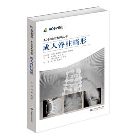 AOSPINE大师丛书-成人脊柱畸形