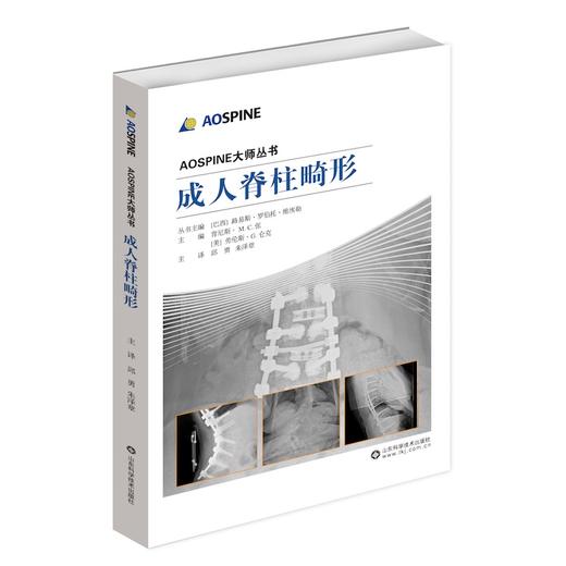 AOSPINE大师丛书-成人脊柱畸形 商品图0