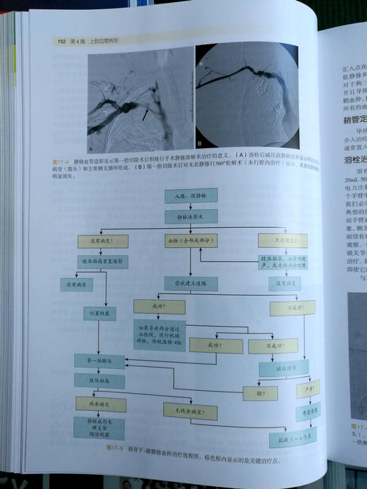 血管手术与血管腔内治疗：解剖图谱与技术指南 商品图8