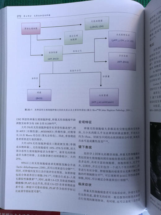 卵巢肿瘤影像学 商品图9