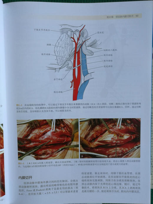 血管手术与血管腔内治疗：解剖图谱与技术指南 商品图6