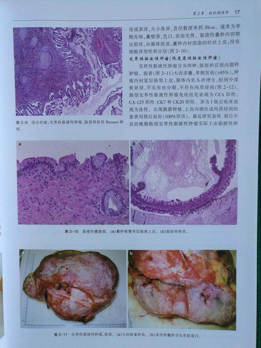 卵巢肿瘤影像学 商品图2