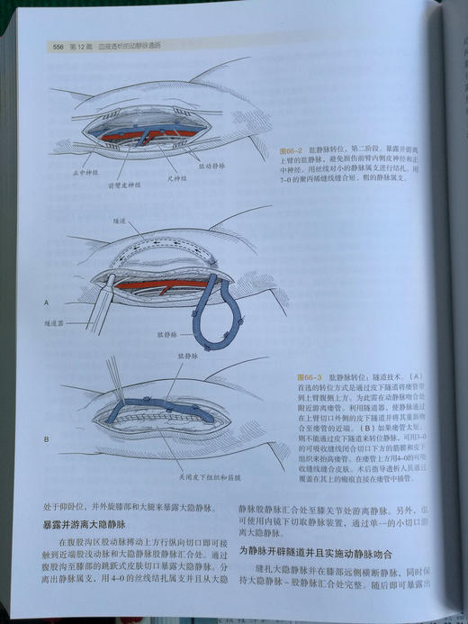 血管手术与血管腔内治疗：解剖图谱与技术指南 商品图12