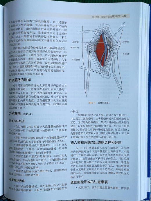 血管手术与血管腔内治疗：解剖图谱与技术指南 商品图11