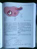 卵巢肿瘤影像学 商品缩略图8