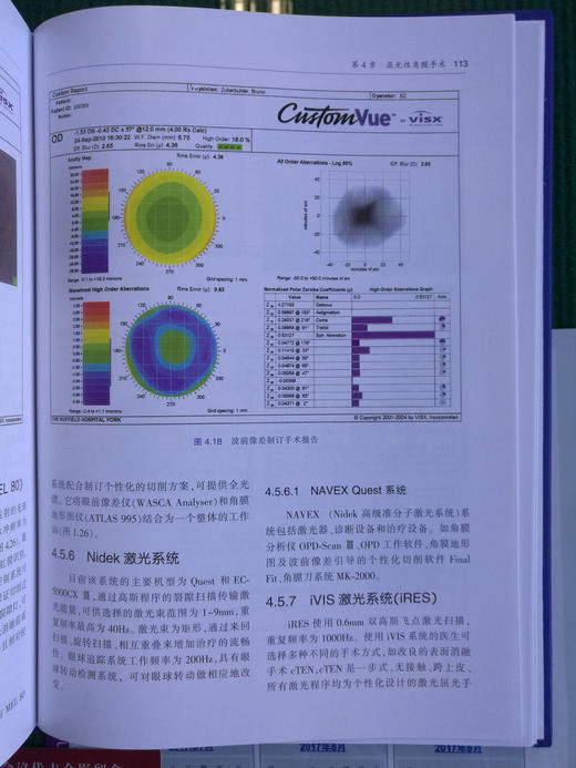 角膜手术基本技术（附赠原版DVD手术视频） 商品图10