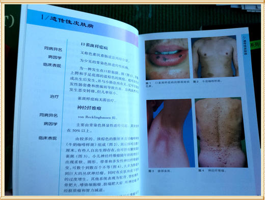 袖珍诊疗彩色图谱系列 商品图11