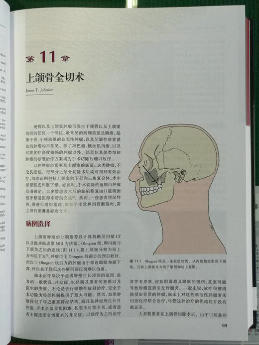 耳鼻咽喉头颈外科手术学（上下卷）-☆ 商品图5