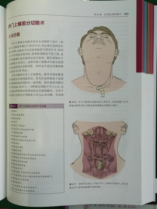 耳鼻咽喉头颈外科手术学（上下卷）-☆ 商品图8