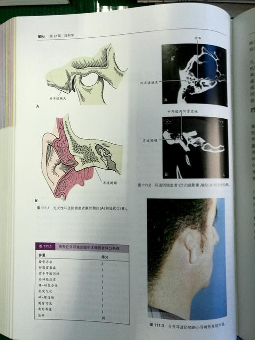 耳鼻咽喉头颈外科手术学（上下卷）-☆ 商品图13