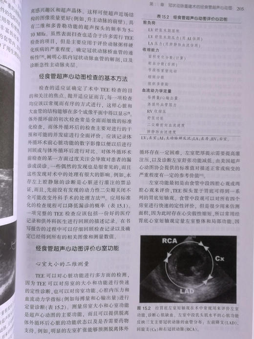 经食管超声心动图实用技术 商品图8