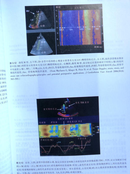 经食管超声心动图实用技术 商品图5