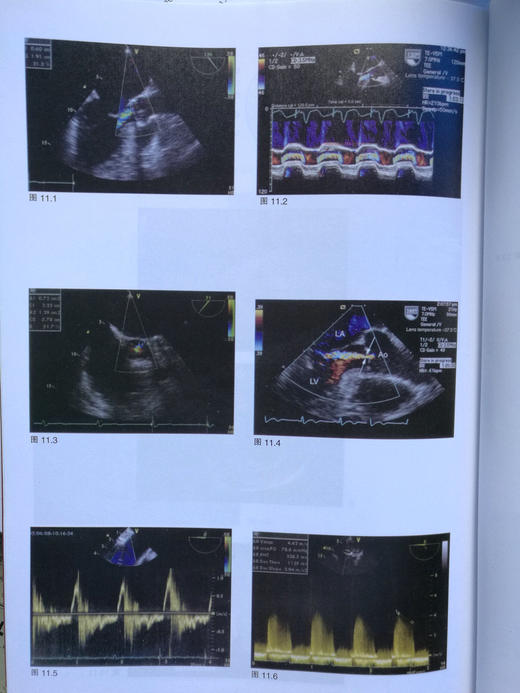 经食管超声心动图实用技术 商品图11