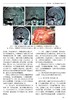 神经外科手术精要与并发症（第2版） 北医社 商品缩略图6
