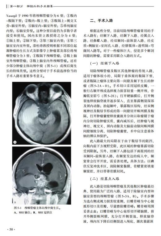 神经外科手术精要与并发症（第2版） 北医社 商品图5