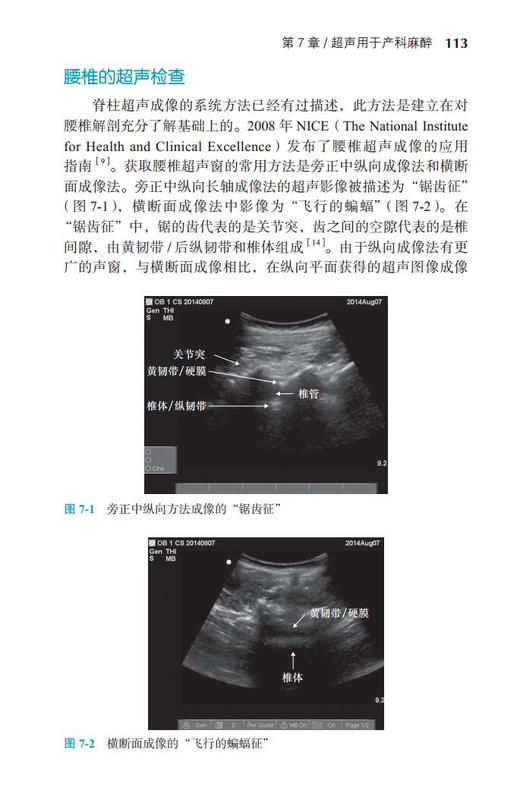 产科麻醉 北医社 主译   陈新忠 商品图5