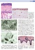 麦基皮肤病理学——与临床的联系（第4版） 北医社 孙建方 高天文 涂平 主译  朱学骏主审 商品缩略图5