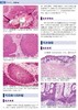 麦基皮肤病理学——与临床的联系（第4版） 北医社 孙建方 高天文 涂平 主译  朱学骏主审 商品缩略图4